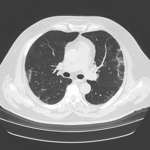 Educational frontal chest radiograph